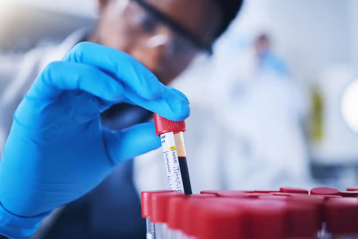 Exposure to Toxic Chemicals at Work title Lab technician holding a vial of blood